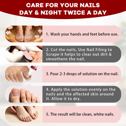 Gentle Toenail Treatment-Strengthens & Beautifies Nails