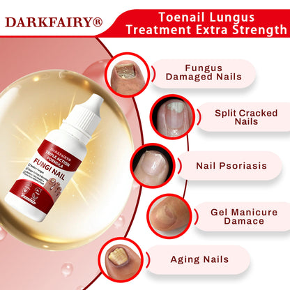 Gentle Toenail Treatment-Strengthens & Beautifies Nails